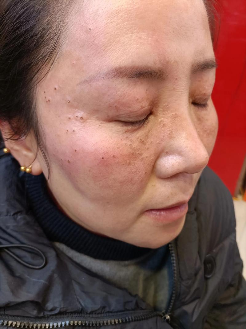 解读隆鼻整形行业的最新趋势